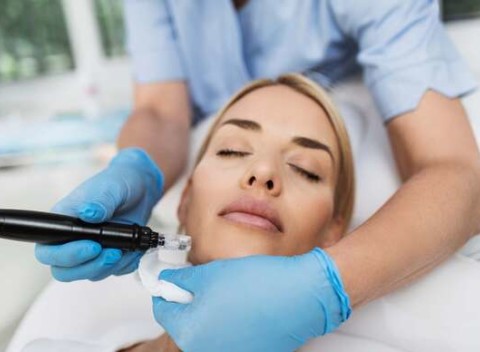 Microneedling – mezoterapia s DermaPen - omladí a zregeneruje pokožku.
