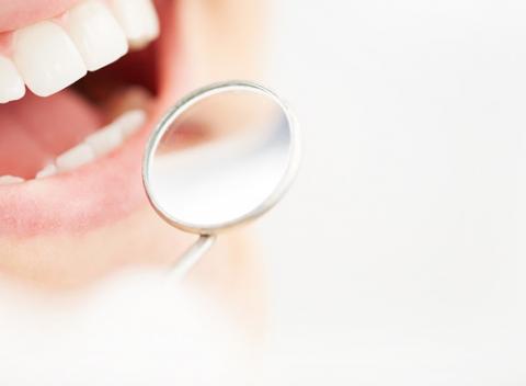 Krásne a zdravé zuby. Ošetrenie zubného kazu či výmena amalgámovej plomby za estetickú bielu výplň a navyše 15 % zľava na ďalšie zákroky.