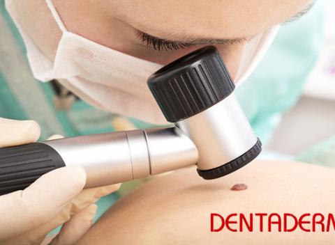 Dermatoskopické vyšetrenie všetkých znamienok na celom tele. Predíďte zhubnému melanómu. Vyšetrí vás špecialista lekár - dermatovenerológ. 