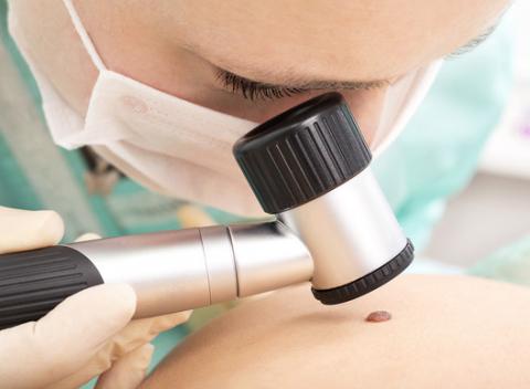 Dermatoskopické vyšetrenie všetkých znamienok. Chráňte si vaše zdravie a absolvujte preventívne vyšetrenie digitálnym dermatoskopom. 