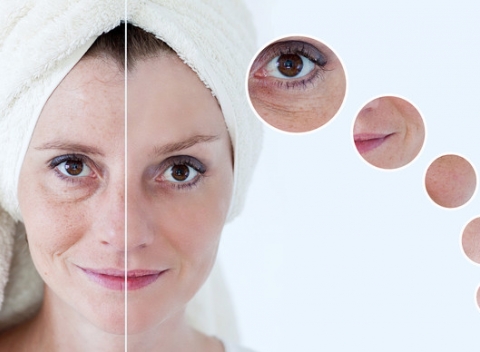 Dermabotexín – botulotoxín intenzívna starostlivosť proti vráskam alebo ultrazvukový lifting tváre. Zobudiť sa znova mladá? Áno!