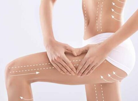 Super postava bez celulitídy: kavitácia, lymfodrenáž alebo vákuová terapia.