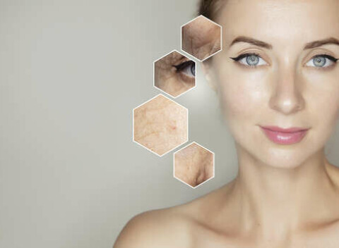 Účinný spôsob, ako pomôcť pleti - ozónoterapia, ktorá zlepšuje, prekrvuje, spevňuje a dezinfikuje.