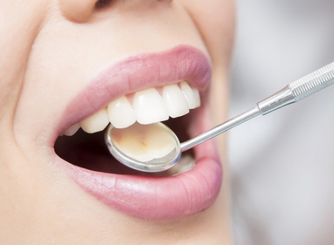 Profesionálna dentálna hygiena s pieskovaním alebo ošetrenie kazu či výmena plomby.