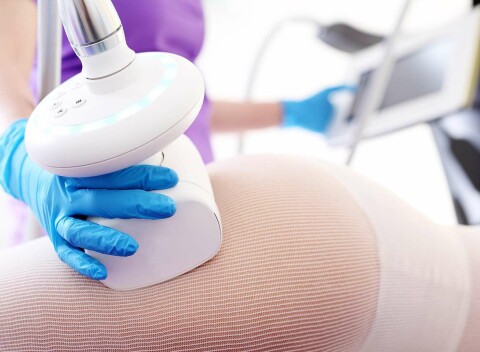 Schudnite bezbolestne s prémiovou liposukciou Ulthera SLIM v Salón Krásy Prestige - Zipava.