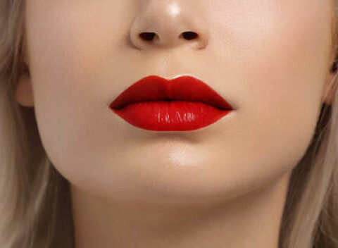 Výplň pier technikou Russian lips alebo odstránenie vrások kys. hyalurónovou.