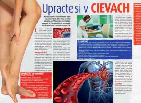 Vyšetrenie a liečba cievneho systému pomocou Sonotherapie – nakopnite si krvný obeh