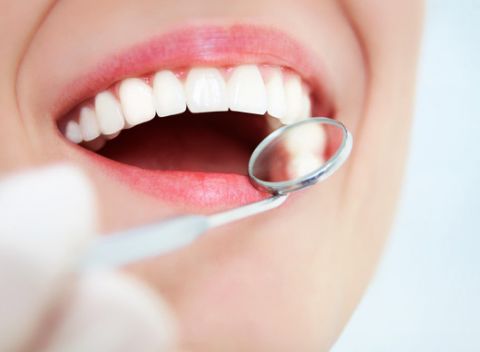 Profesionálna komplexná dentálna hygiena v dentálnom centre Verona v Prešove.