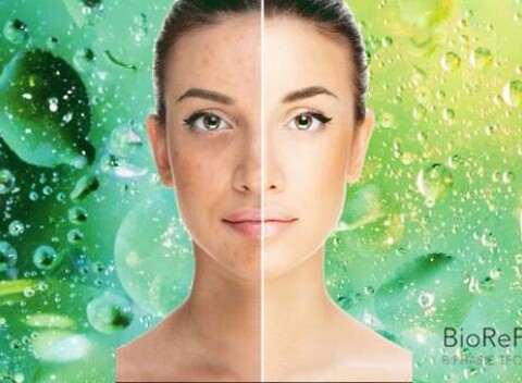 Multifunkčné peelingové ošetrenie v kombinácii s mezoterapiou pre dokonale mladú pleť