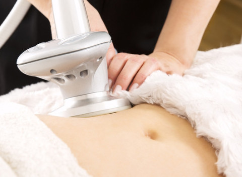 Neinvazívna liposukcia Lipolaserom. Neinvazívna liposukcia pomôže neprispôsobivým krivkám.