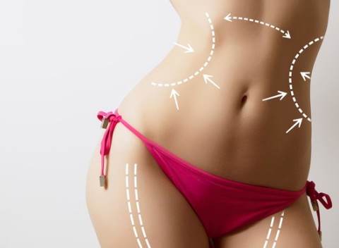 Zoštíhlenie tváre aj tela injekčnou lipolýzou - alternatíva lokálnej liposukcie pre redukciu tuku.