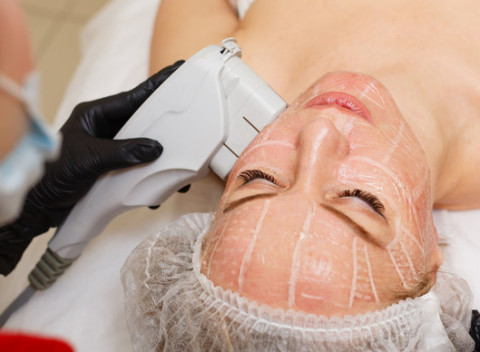 Rozžiarte svoju pleť pomocou novinky Hi-FU - ULTHERY - facelifting ULTHERA terapia.