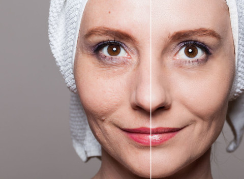 Zbavte sa ochabnutej pleti a získajte dokonalejší tvar tváre. Na výber z 5 kozmetických procedúr.