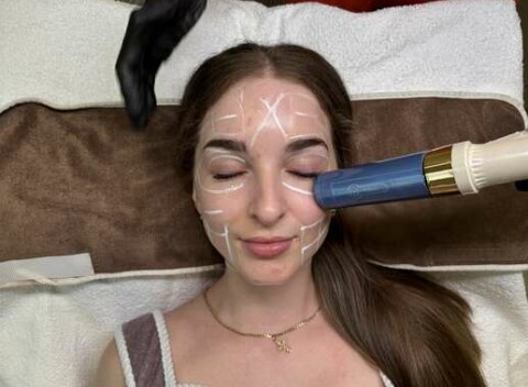 HIFU – revolučné spevnenie pleti a formovanie tela bez skalpela