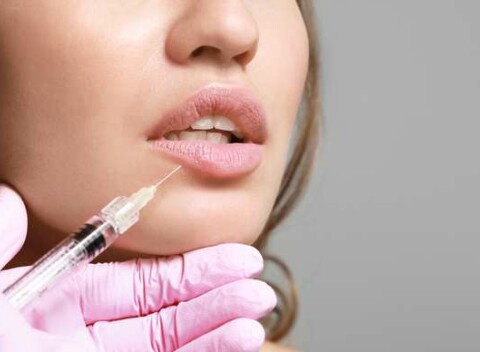 Výplň pier technikou Russian lips alebo odstránenie vrások kys. hyalurónovou