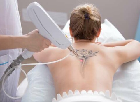 Laserové odstránenie tetovanie alebo PMU v Maya Beauty Clinic