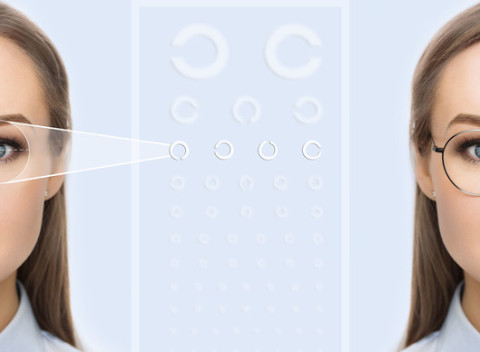 Laserová refrakčná operácia oboch očí excimerovým laserom Epi-LASIK v zdravotníckom centre PANMED.