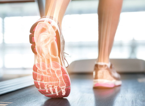 Ortopedické vložky SIDAS (prémiová francúzska kvalita) a diagnostika chodidiel na podoskope.