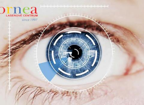 Laserová operácia očí Žiadna bolesť počas a ani po operácii