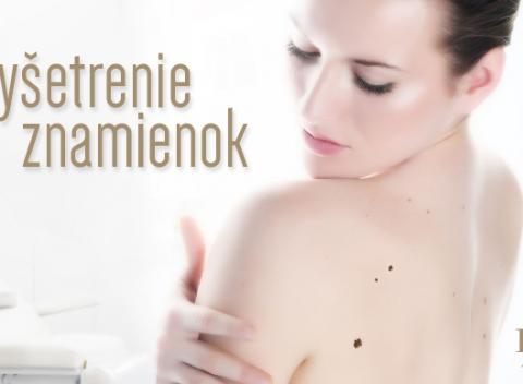 Dôležitá prevencia Dermatoskopické vyšetrenie znamienok