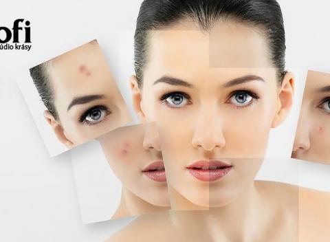 Kompletné ošetrenie pleti 2v1 alebo kompletné ošetrenie pleti s galvanizáciou 3v1 s kozmetikou Syn Care + grátis úprava obočia!