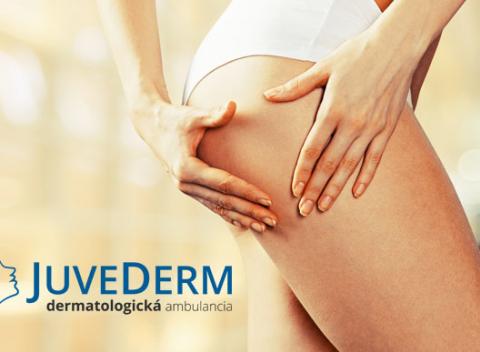 Zbavte svoje telo toxínov a aktivujte si lymfatický systém pomocou lymfodrenáže v dermatologickej ambulancií Juvedermáž.