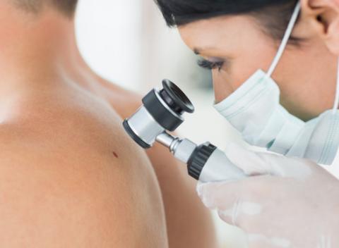 Vyšetrenie znamienok digitálnym dermatoskopom. Nechajte sa vyšetriť ešte dnes a predíďte prípadným starostiam neskôr.