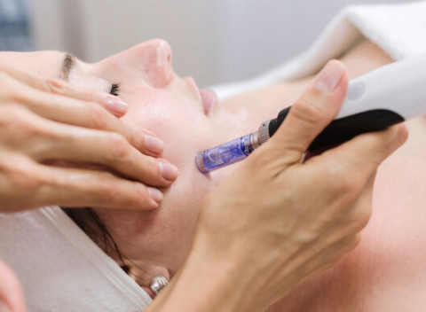 Mezoterapia, ošetrenie na podporu tvorby kolagénu - obnovuje, vyhladzuje, rozjasňuje a hydratuje.